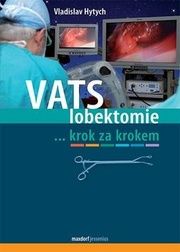 VATS lobektomie