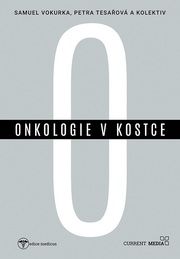Onkologie v kostce