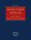 Histiocytární neoplazie a další vybrané vzácné krevní nemoce